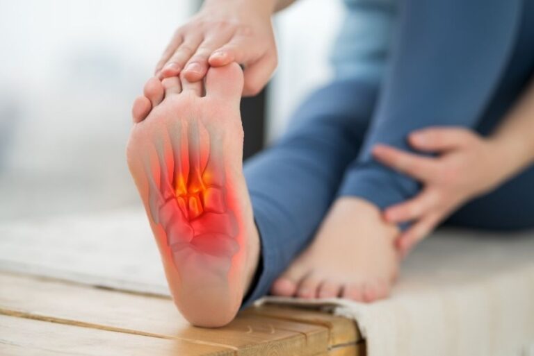 fascite plantare dolore tallone sintomi fisioterapia